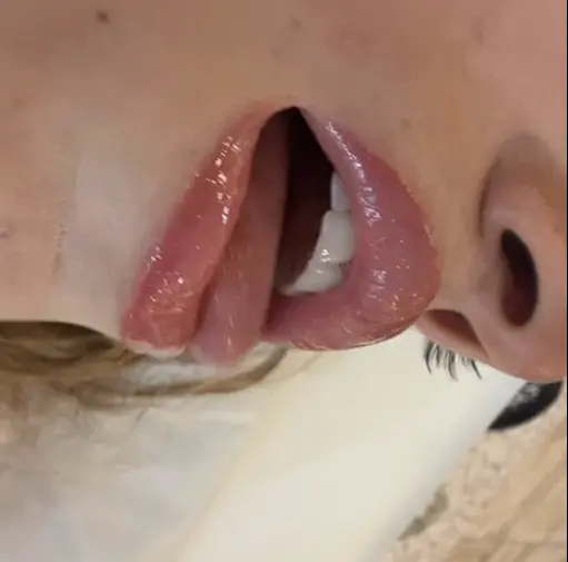 latest lips tease set